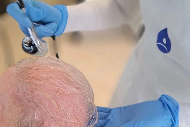 Oxygeni Hair oxigénterápia, hajhagyma, mikrokeringés, Kazincbarcika
